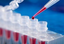 नेपालमा कोरोना संक्रमितको संख्या ५ हजार नाघ्यो